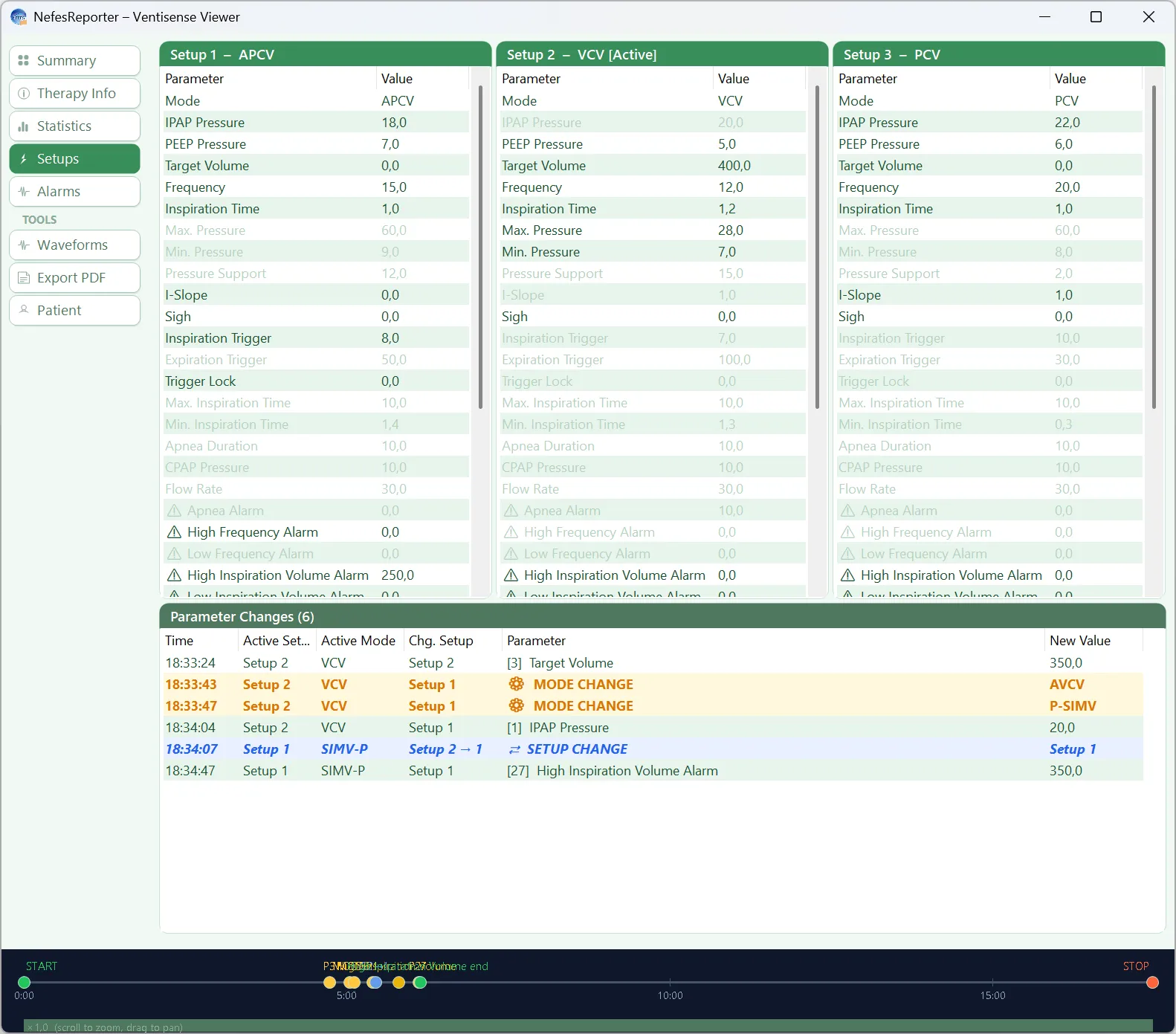 Parameters & settings