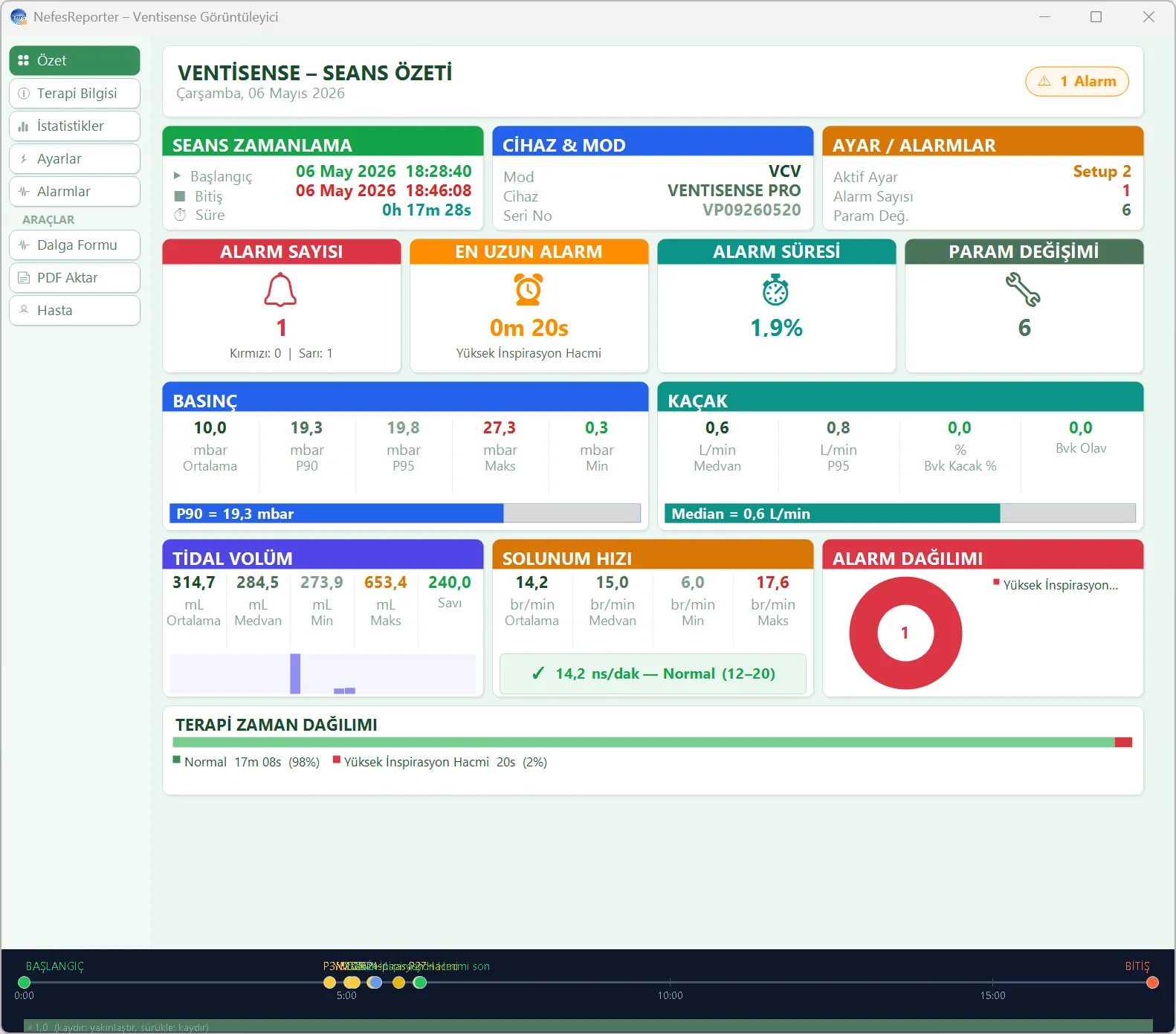 Ventisense session summary