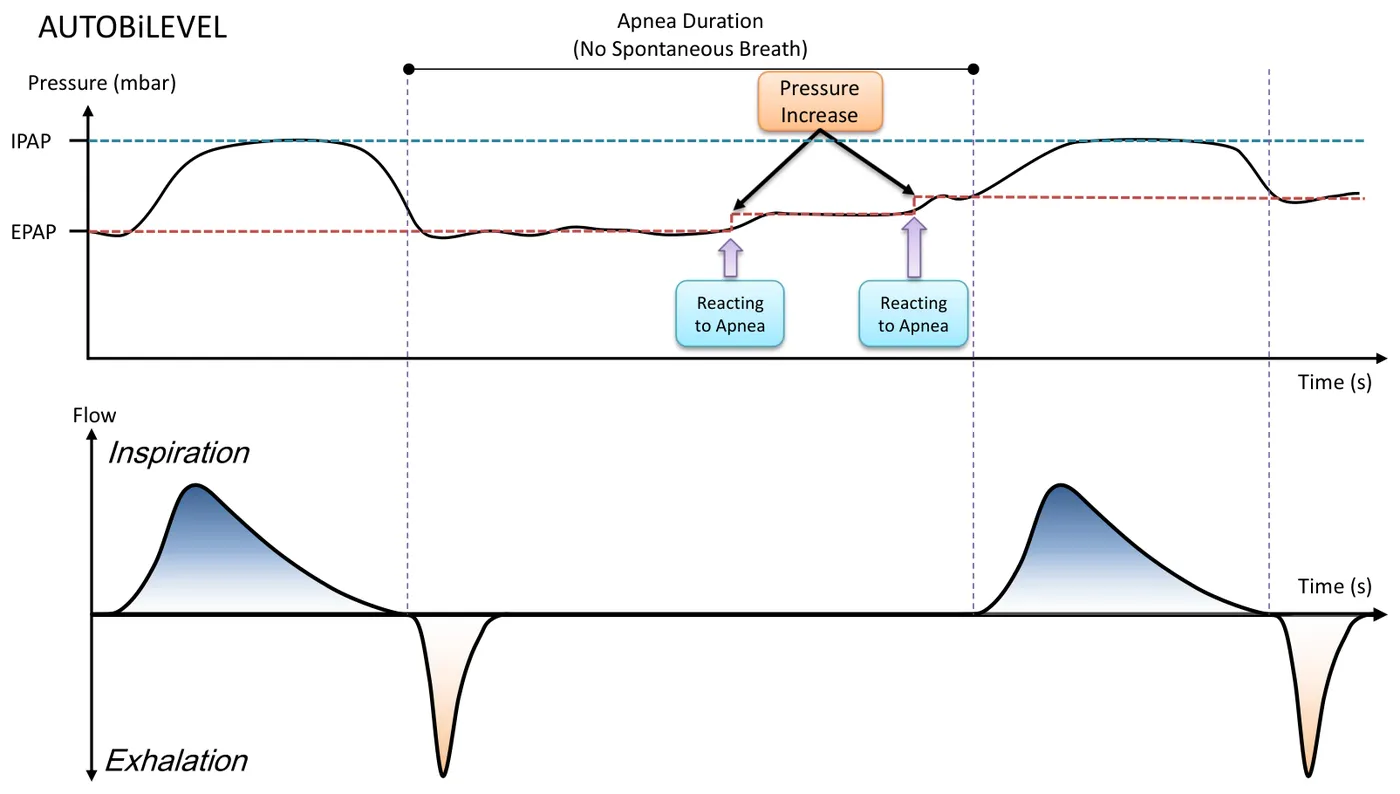 AUTOBiLEVEL Kurvenform
