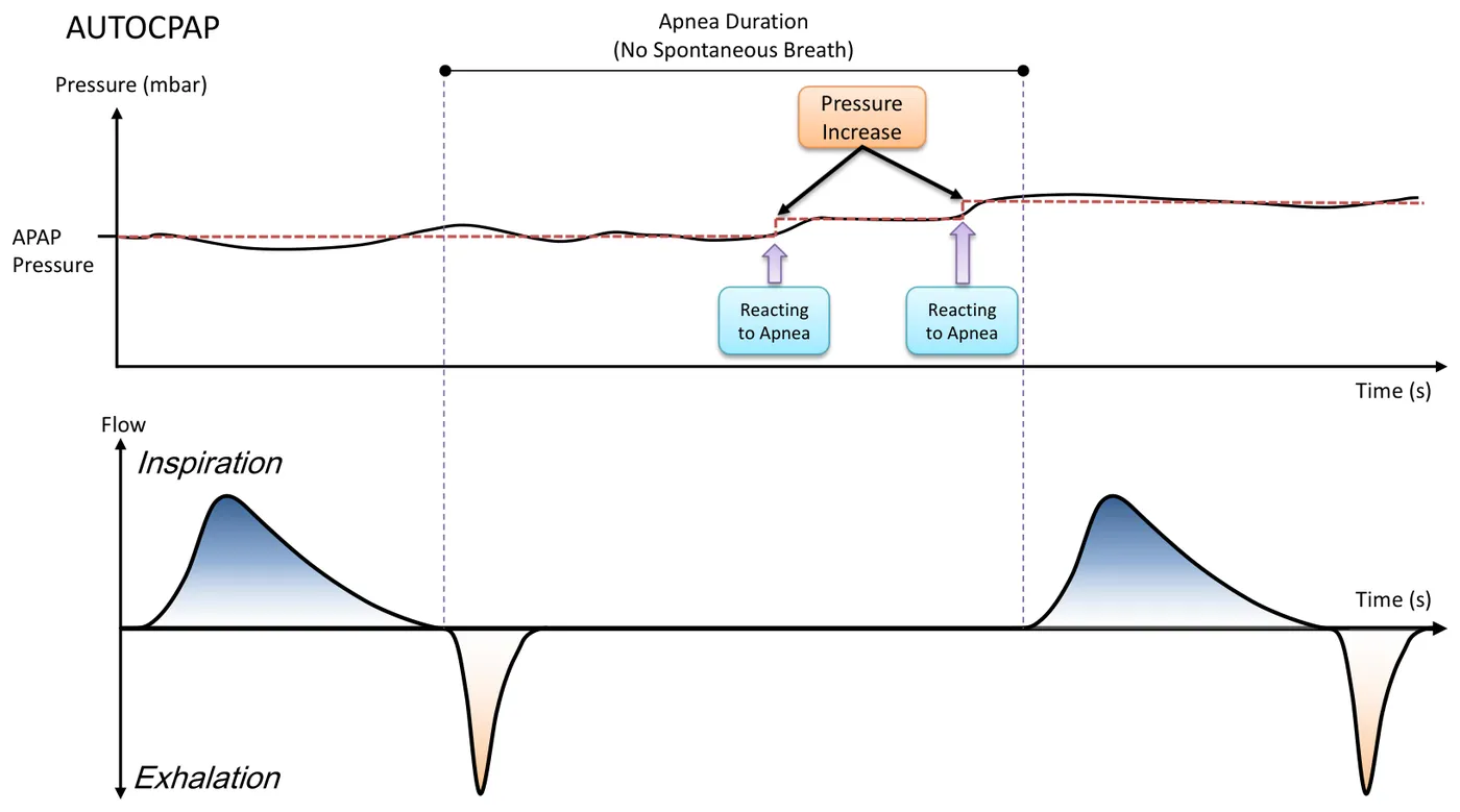 AUTOCPAP Kurvenform