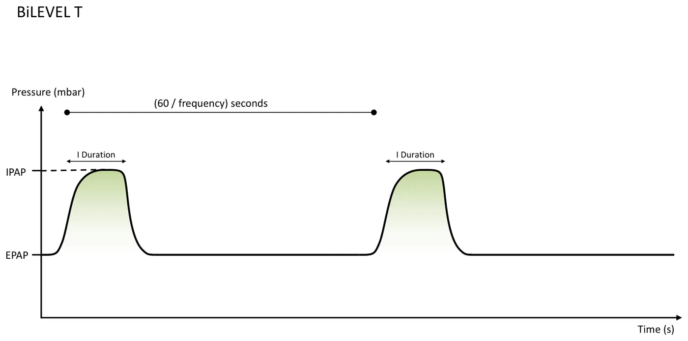 BiLEVEL T Kurvenform