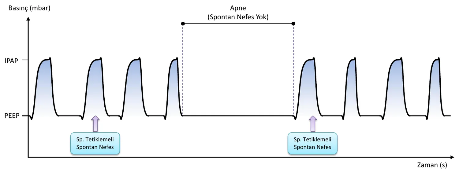 BiLEVEL waveform