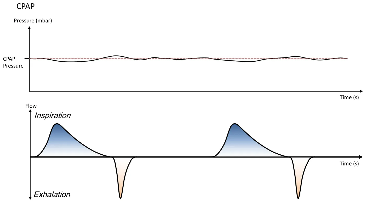 CPAP Kurvenform