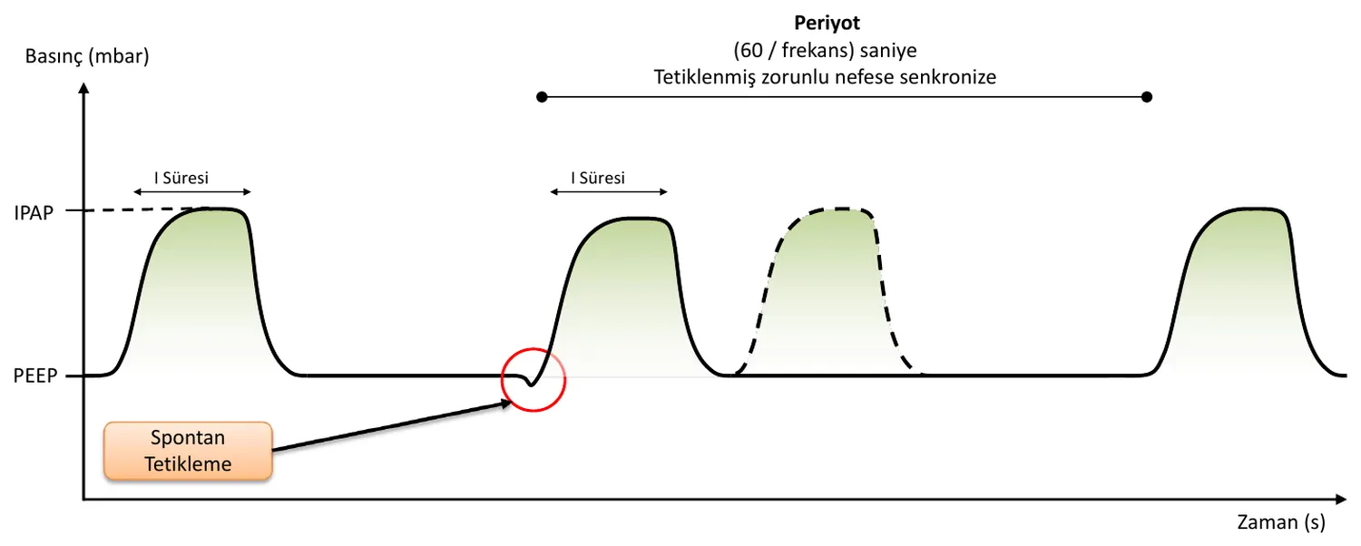 PCV-A waveform
