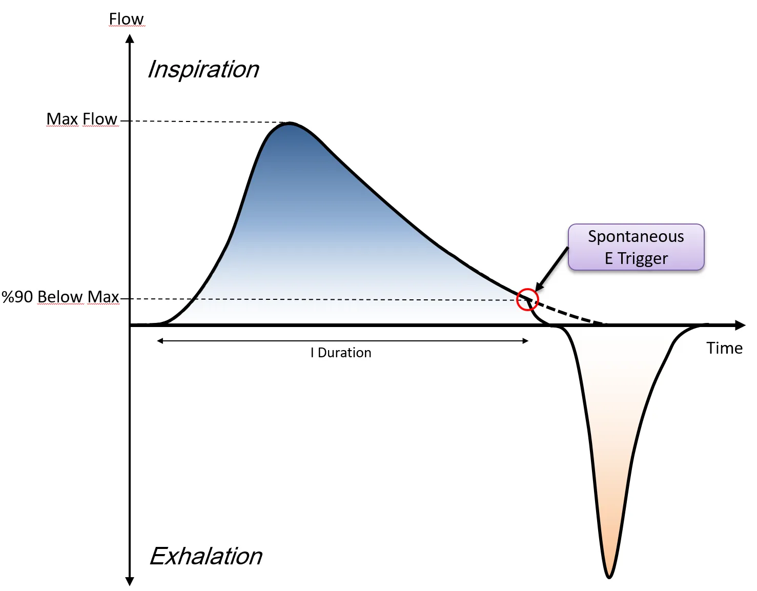 Déclenchement expiratoire 100 % — cyclage le moins sensible.