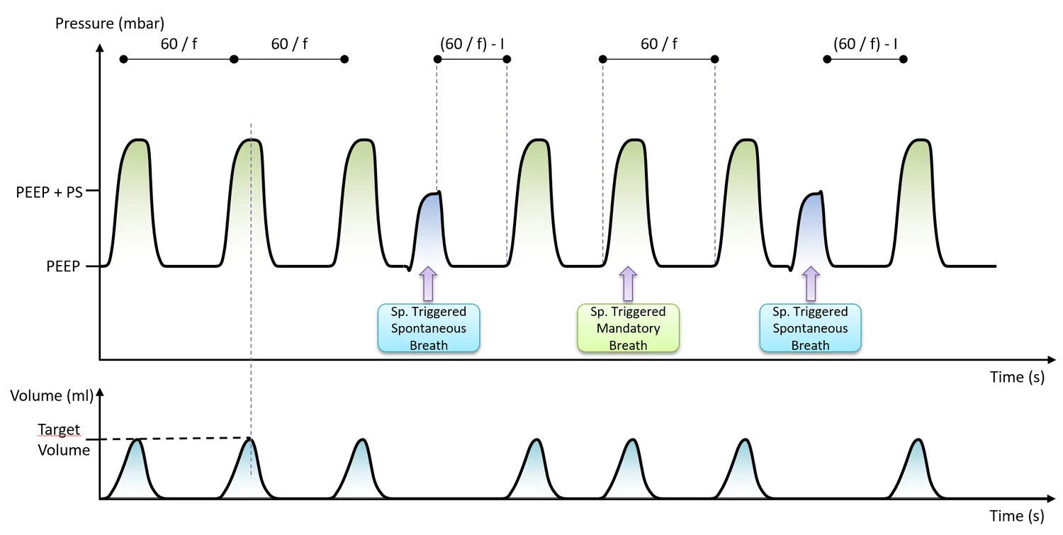SIMV-V waveform