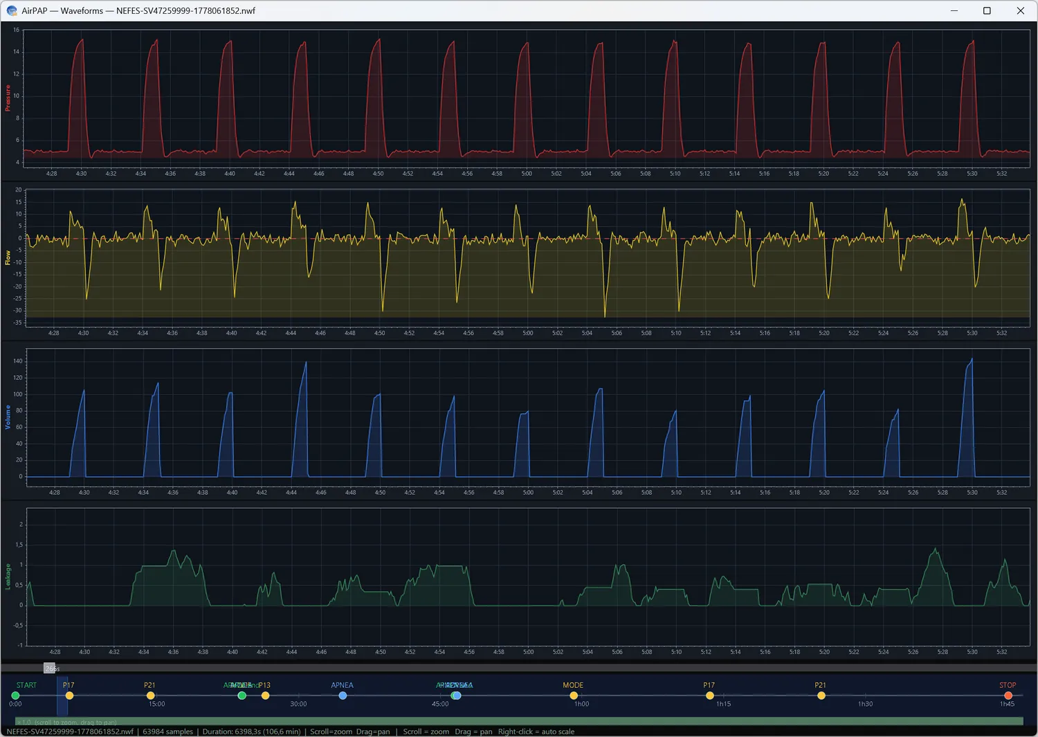 Waveform review